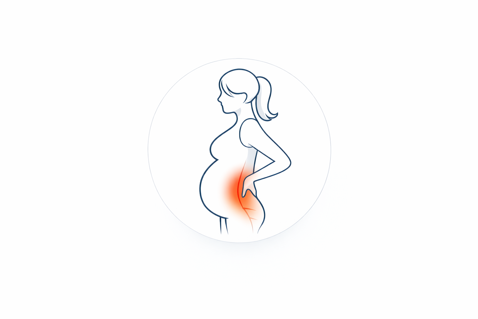 Pregnancy-related back pain illustration